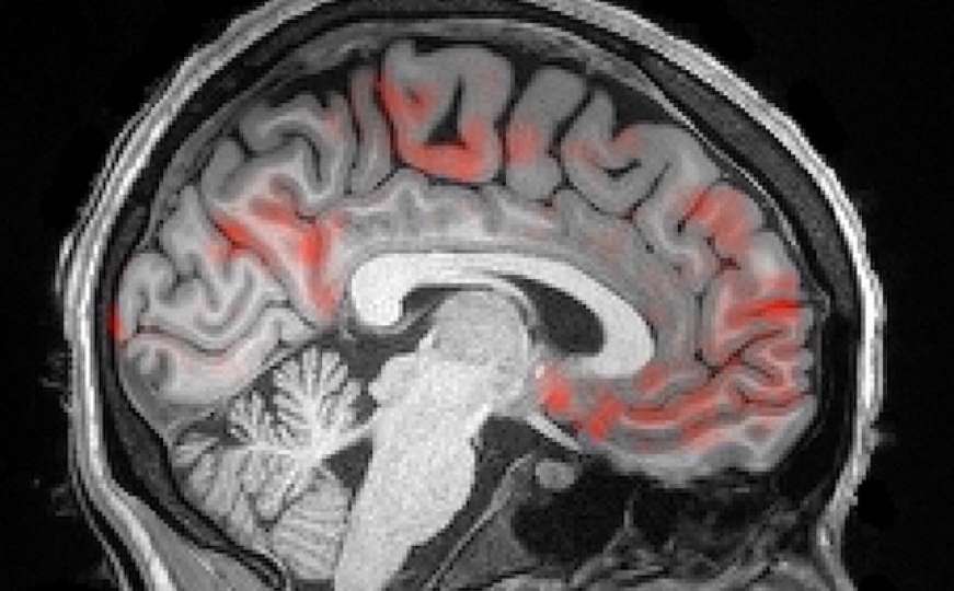 Najnovije istraživanje: Pogledajte kako se mozak "čisti" tokom noći