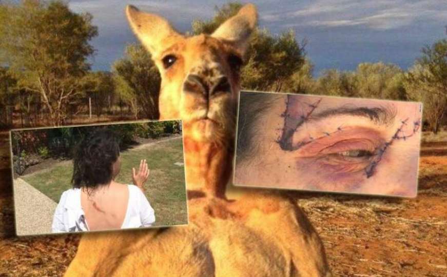 Ženu teško povrijedio kengur: "Zaradila" je 25 šavova, i to samo na licu!