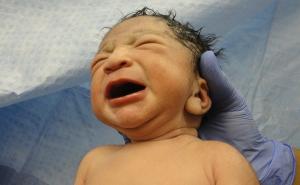 Rijedak fenomen: Beba rođena trudna, a odmah joj trebao i carski rez