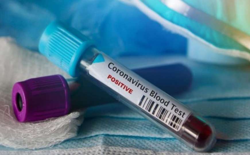 Koronavirus se proširio čak na 22 države u svijetu: Evo i koje
