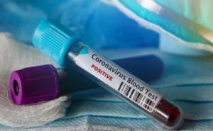 Sarajevo: Formirano Koordinaciono tijelo za praćenje situacije s koronavirusom