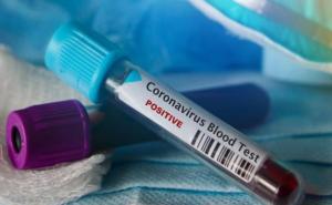 Novi slučaj sumnje na koronavirus u Zagrebu