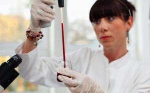 Švedski naučnici objavili koja krvna grupa je najotpornija na maligne bolesti
