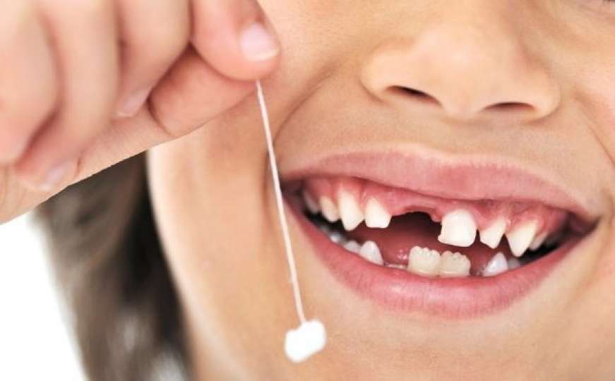 Čuvajte mliječne zubiće mališana, jer bi im oni mogli spasiti život