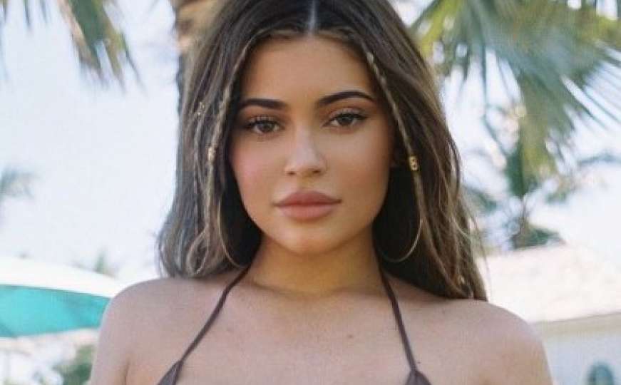 Kylie Jenner šokirala fanove novim izgledom: Šta sve može plastična hirurgija 