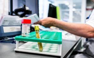 Učenica iz Čelinca zaražena koronavirusom