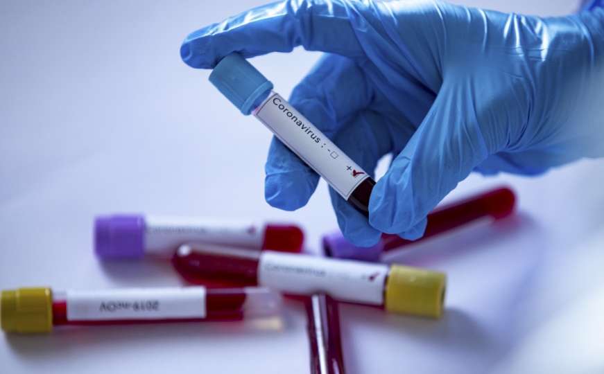 Srbija potvrdila pet novih slučajeva zaraze koronavirusom