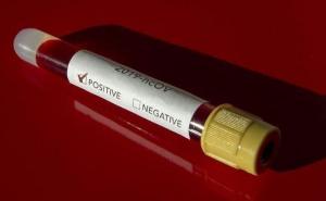 Kosovo: Četiri nova slučaja oboljelih od COVID-19, ukupno 13 zaraženih