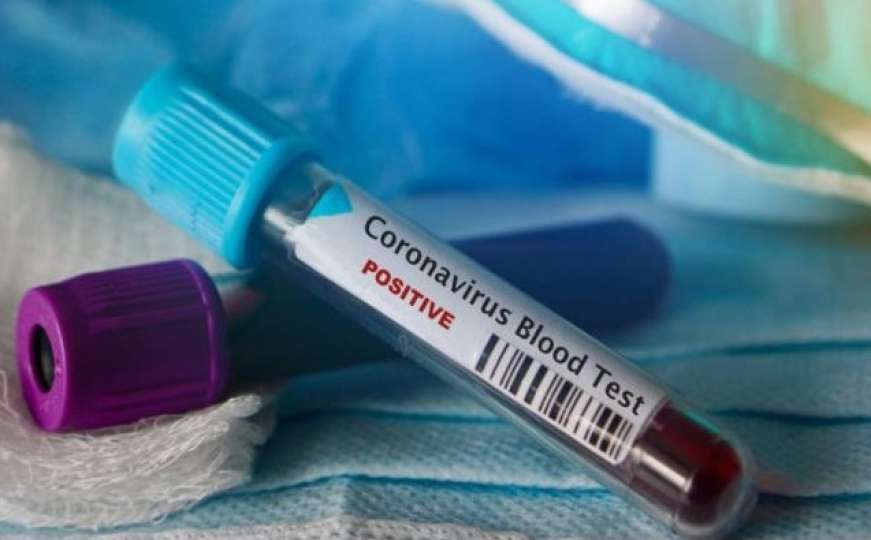 Prvi slučaj koronavirusa u Hercegovini