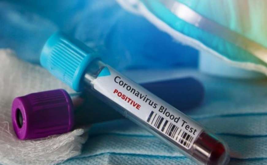Sedam novih slučajeva koronavirusa u BiH 