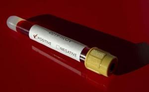 U Hrvatskoj 15 novooboljelih, ukupan broj porastao na 128