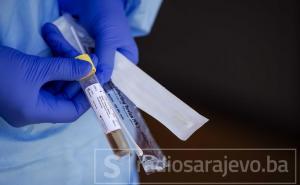 Na COVID-19 pozitivno još pet osoba u Bosni i Hercegovini