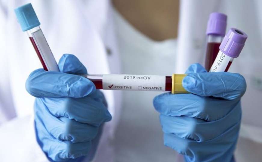 Virus COVID-19 stigao u Tuzlanski kanton: Dvije osobe zaražene nakon 168 testova