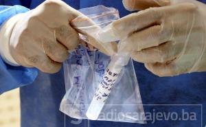 Šeranić o posuđivanju testova iz FBiH: Nije to ništa neuobičajeno, vratit ćemo