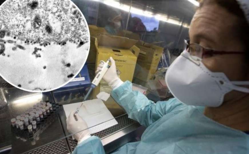 Naučnici snimili trenutak u kojem koronavirus inficira stanicu