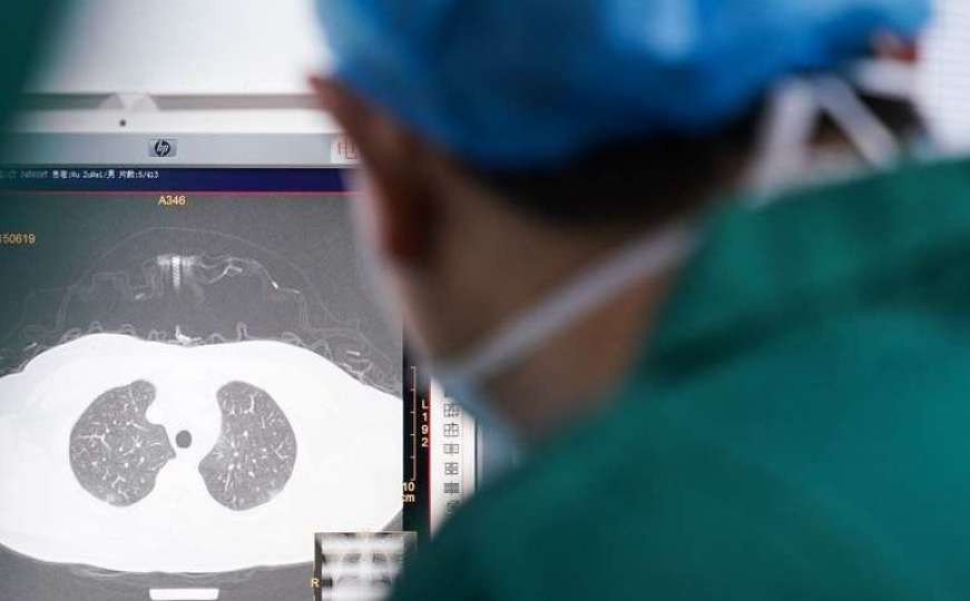 Doktori objavili novo istraživanje i upozorili - COVID ne uništava samo pluća