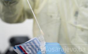 KCUS: Tokom noći testirano 158 uzoraka, jedna osoba pozitivna na COVID-19