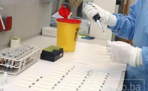 RS: Još 53 slučaja zaraze koronavirusom