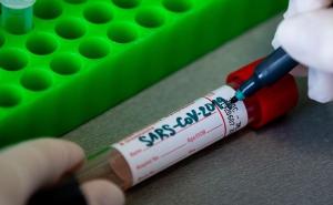 Testirana 62 uzorka: U Kantonu Sarajevo nema novozaraženih osoba