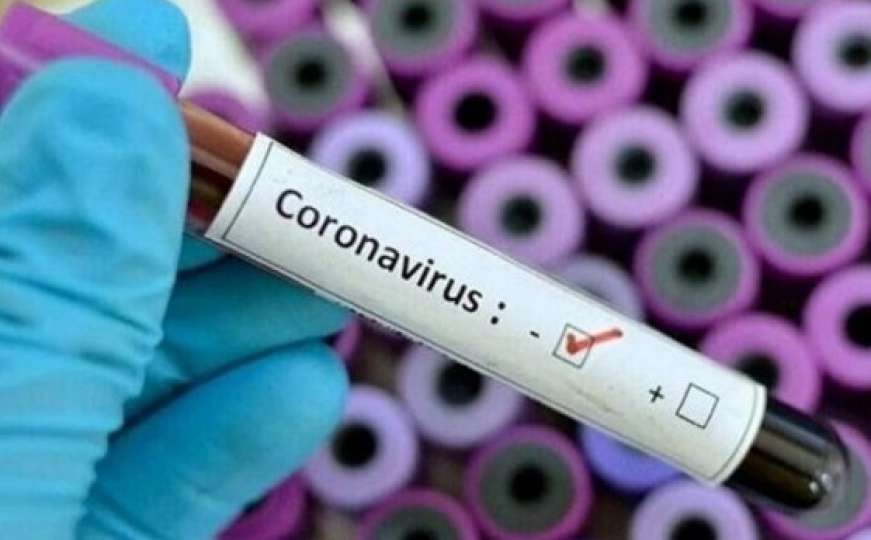 Ne jenjava pandemija virusa Covid-19 u RS-u: Zaraženo još 27 osoba