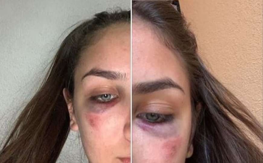 Reprezentativke BiH u karateu: Ema i Ena Selman (18) pretučene u svom stanu