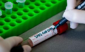 Novi pozitivni slučajevi koronavirusa potvrđeni u Tuzlanskom kantonu