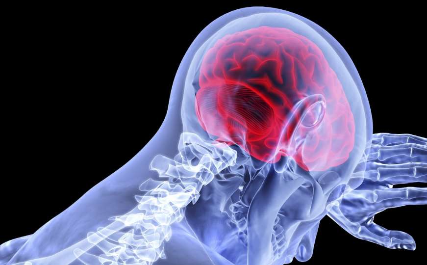 Neurolozi otkrili: Moždani poremećaji i kod onih s blažim simptomima COVID-19