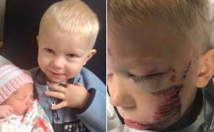 Dječak (6) hrabro spasio sestricu od pobješnjelog psa, dobio je 90 šavova