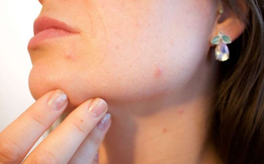 Dobro pogledajte kožu i usta: Ako se desi ova promjena, može biti koronavirus