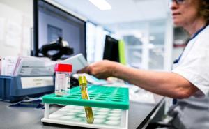Šta je PCR, a šta serološki test: Koje su razlike, prednosti i mane