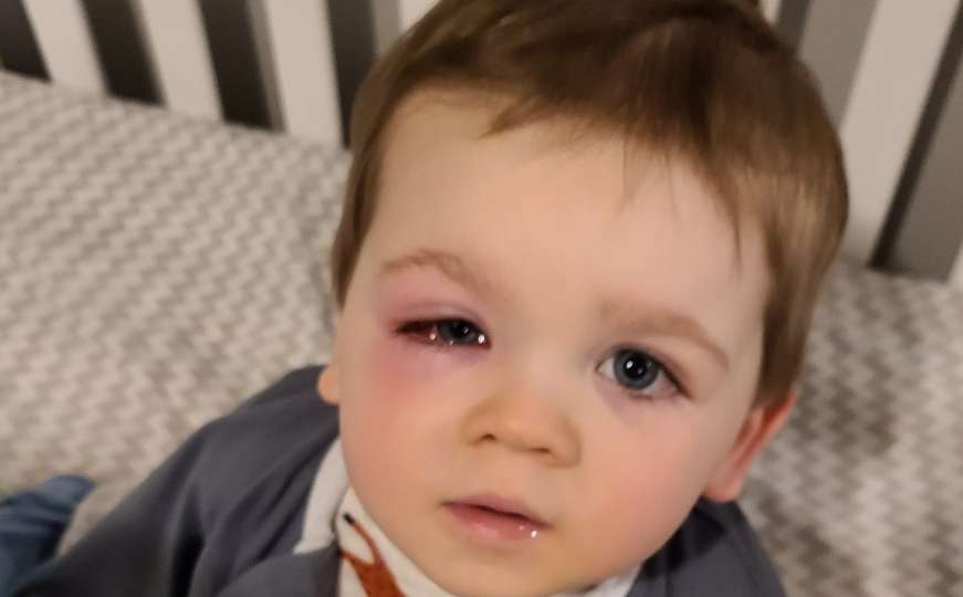 Majka upozorila na opasnost prljavih igračaka u kadi: Sinčić joj umalo oslijepio