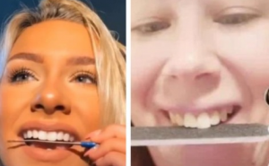 Bizarni trend širi se TikTokom: Turpijom za nokte bruse zube! 