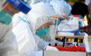 Eksperti: Nakon koliko vremena se koronavirus može ponovo javiti kod iste osobe