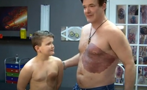 Kanada: Otac je u znak podrške tetovirao ogroman mladež kakav ima sin