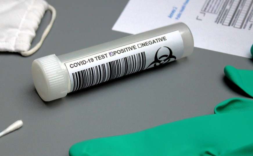 Vrlo jednostavno: U apoteke stigli kućni testovi na koronavirus, cijena 21 KM 