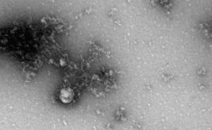 Napravljena prva fotografija britanskog soja koronavirusa 