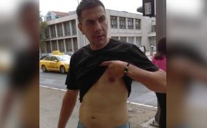 Zatekao ga kod bivše pa potegao nož: Prijeti mu 10 godina robije