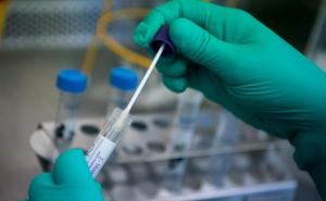 U regiji brojke u porastu, vlasti upozoravaju na maksimalan oprez