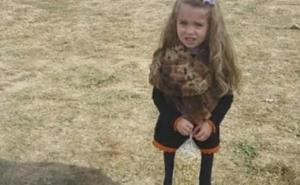 Fotografija koja je podijelila internet: Pogledajte noge ove djevojčice