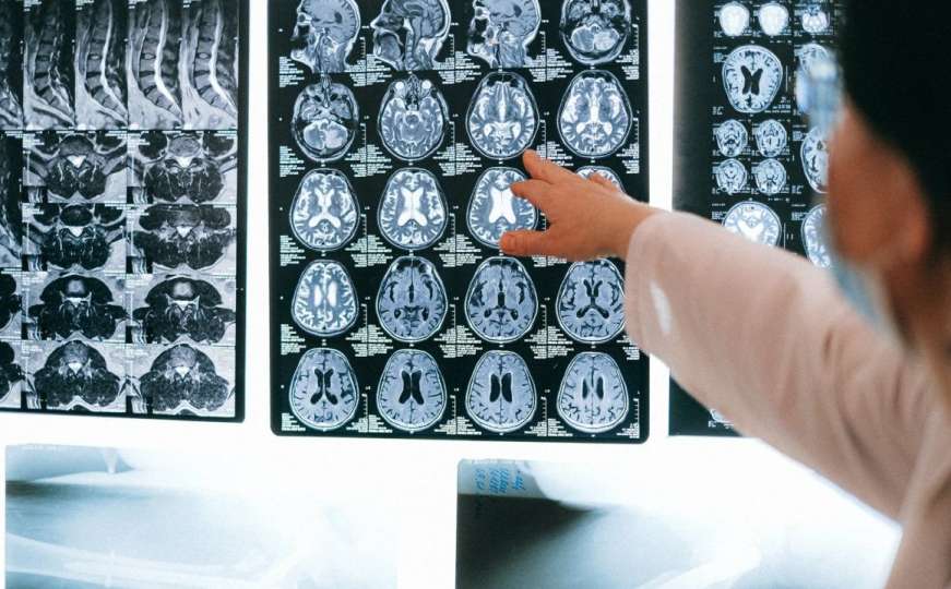 Misteriozni poremećaj mozga kod 43 osobe zbunio kanadske ljekare: U toku istraga