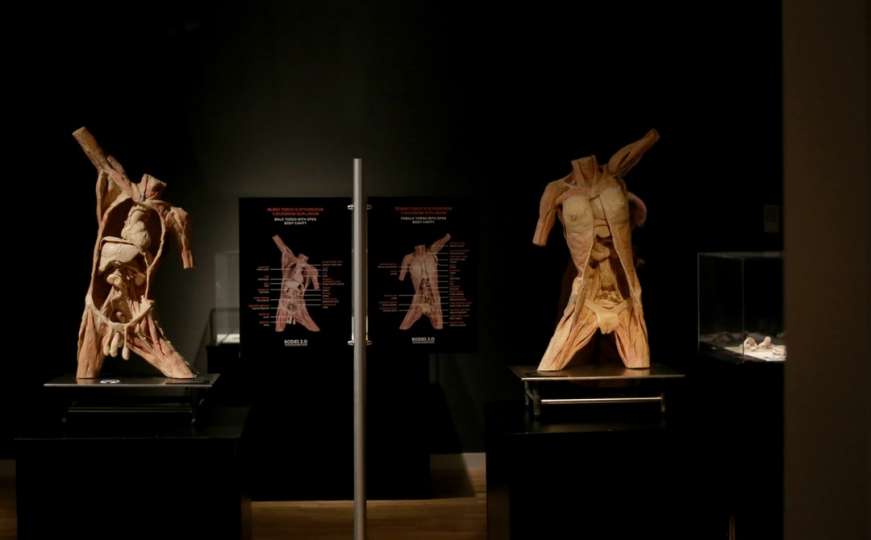 U Zagrebu intrigantna izložba stvarnih ljudskih tijela i organa