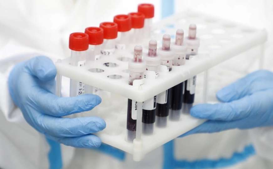 Jeftiniji i brži test na antitijela najnovije oružje u borbi protiv koronavirusa
