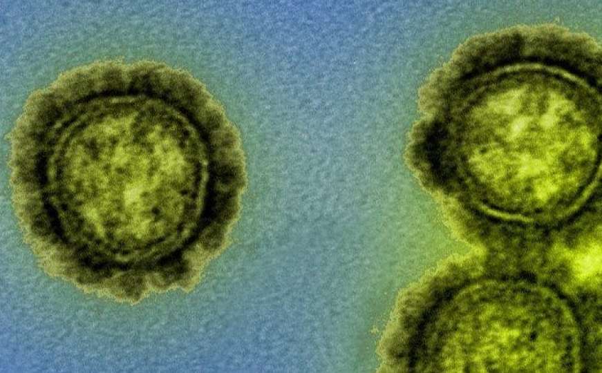 Naučnici provjeravaju izvještaje: Dva soja virusa gripe možda su izumrla?
