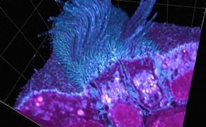 Pogledajte snimak: Kako izgleda ljudska ćelija koju je inficirao koronavirus