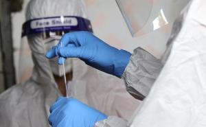 Epidemiološka situacija u BiH: Od posljedica koronavirusa preminulo 30 osoba