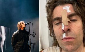Muzičar Liam Gallagher tvrdi da je "ispao iz helikoptera" 