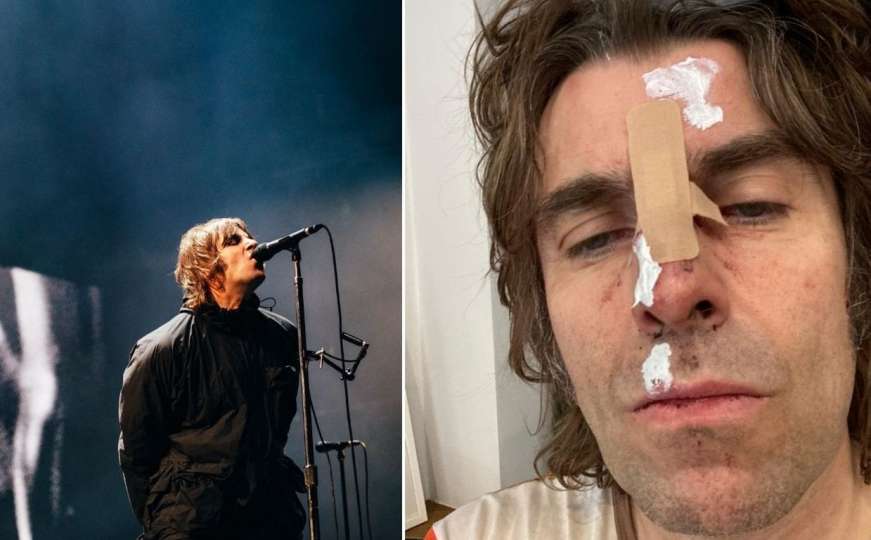 Muzičar Liam Gallagher tvrdi da je "ispao iz helikoptera" 
