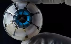 Prvoj osobi u svijetu ugrađeno 3D štampano oko