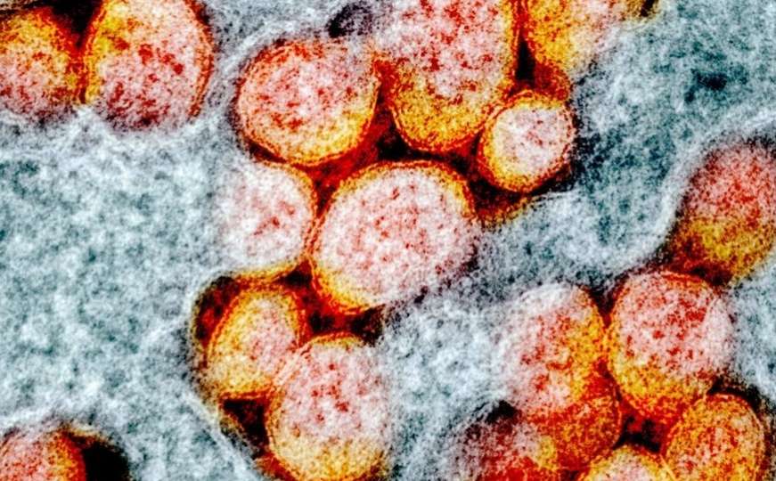 Da li ste čuli za "deltakron" varijantu koronavirusa: Evo šta kaže nauka