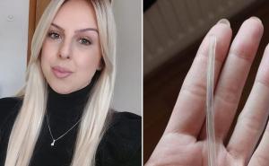 Selmi u grudima ostala silikonska cijev nakon operacije tumora u BiH